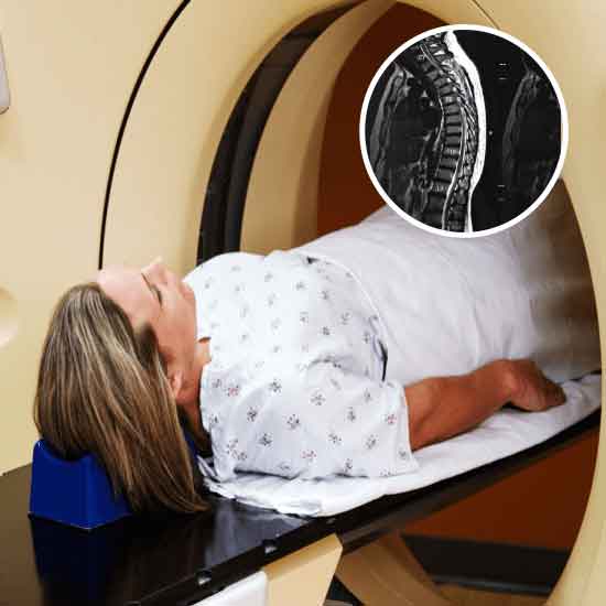 MRI Screening Dorsal Spine